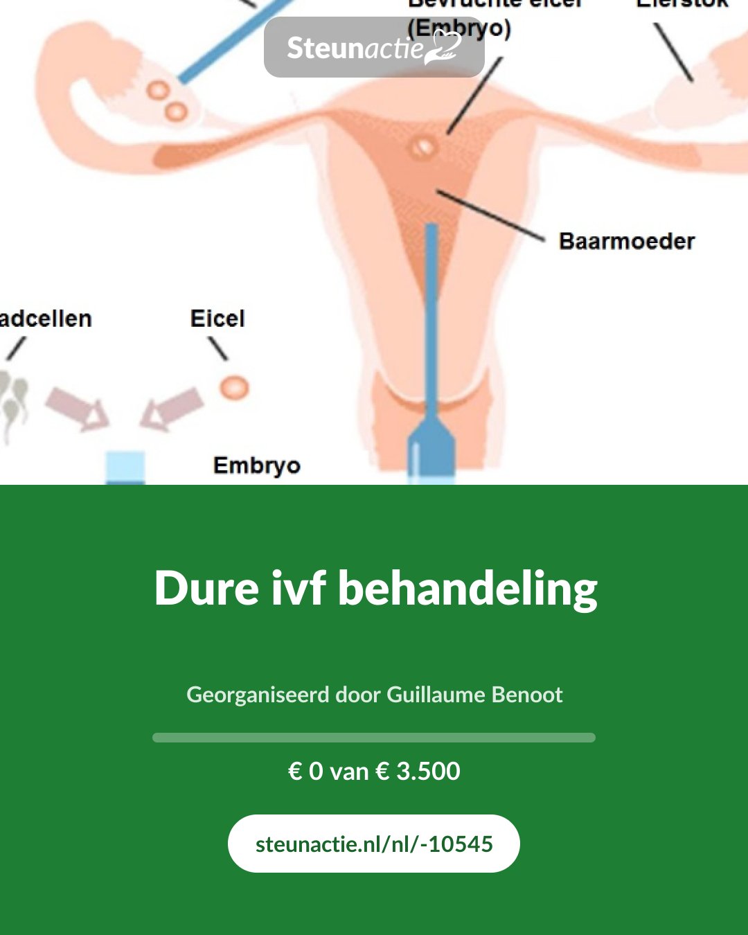 Voorbeeld van de afbeelding