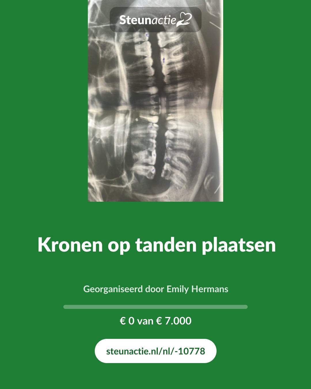 Voorbeeld van de afbeelding