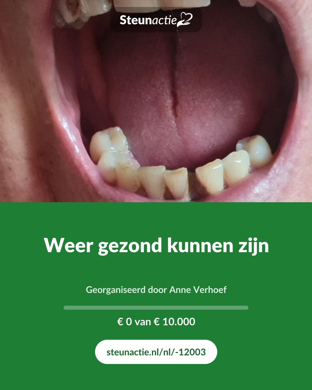 Voorbeeld van de afbeelding