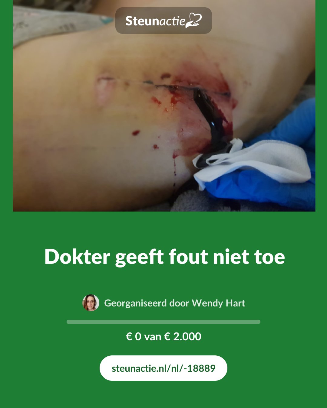 Voorbeeld van de afbeelding