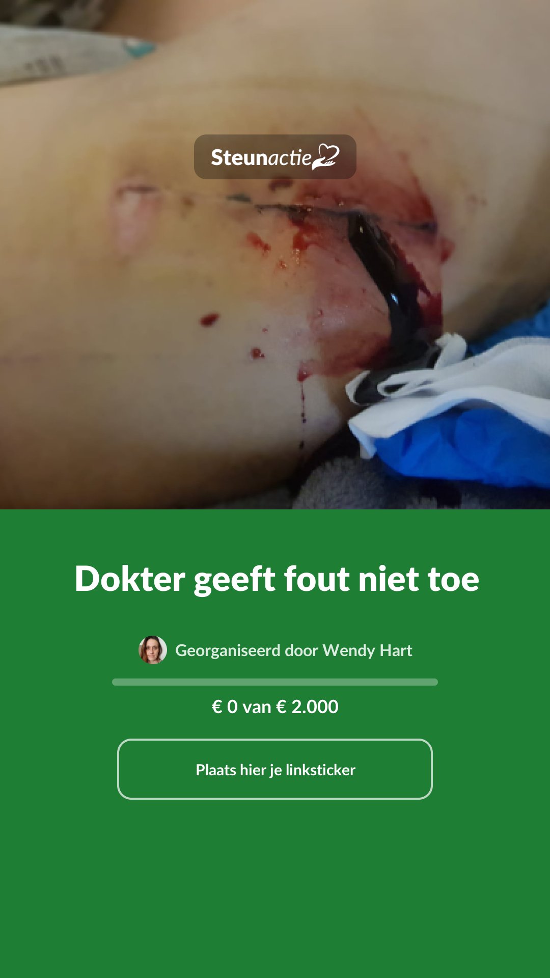 Voorbeeld van de afbeelding