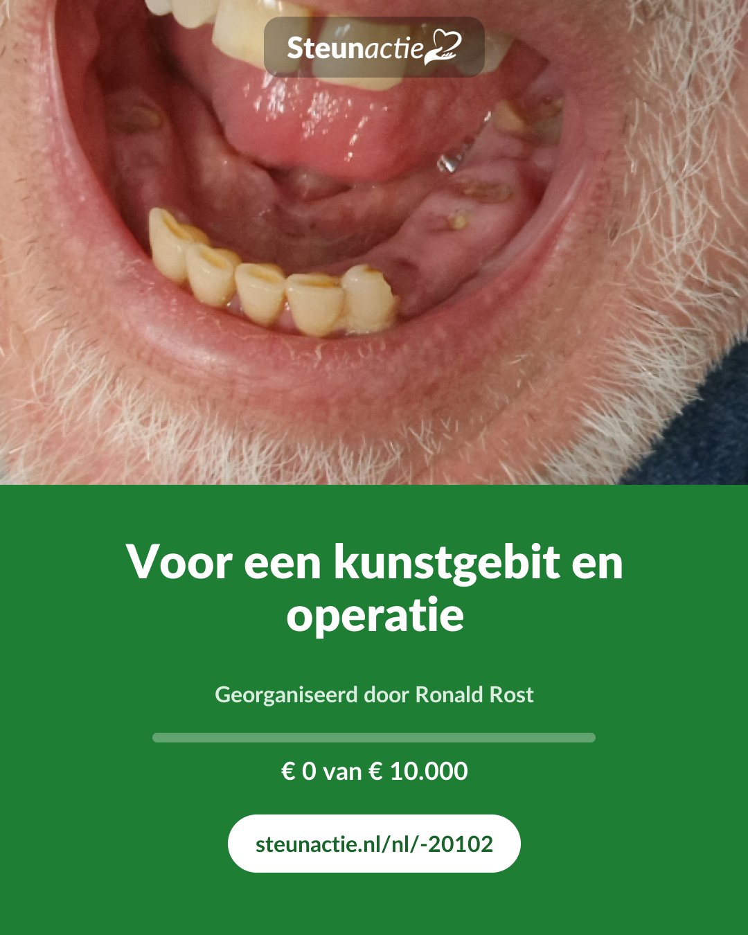 Voorbeeld van de afbeelding