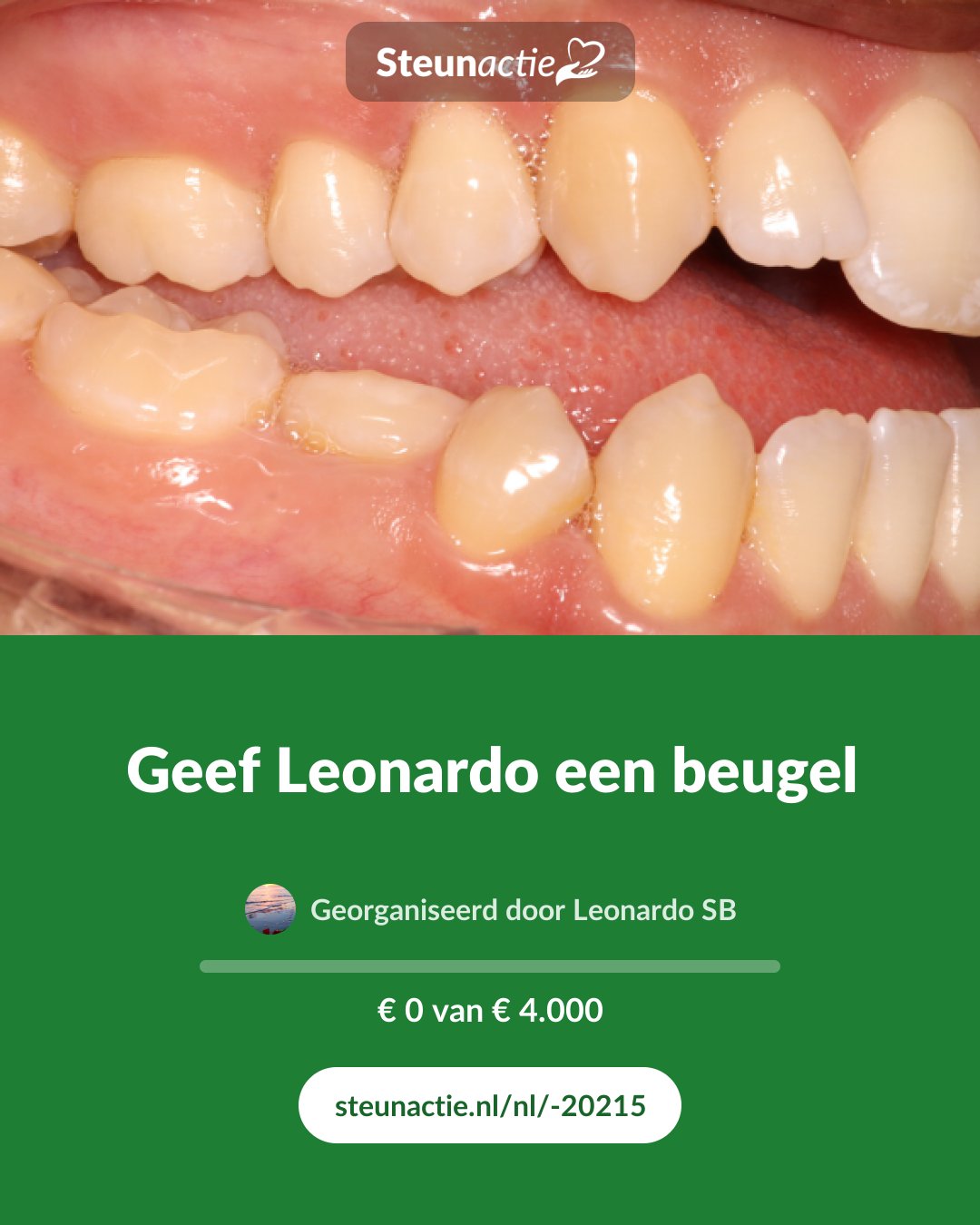 Voorbeeld van de afbeelding