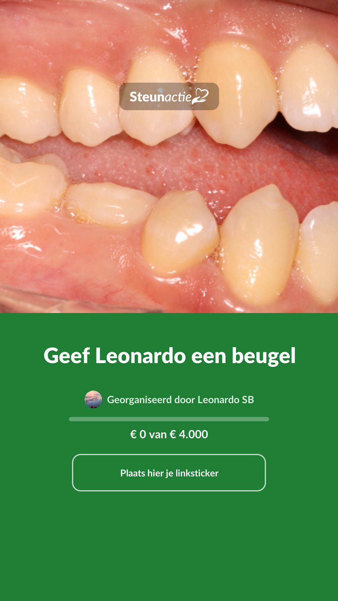 Voorbeeld van de afbeelding