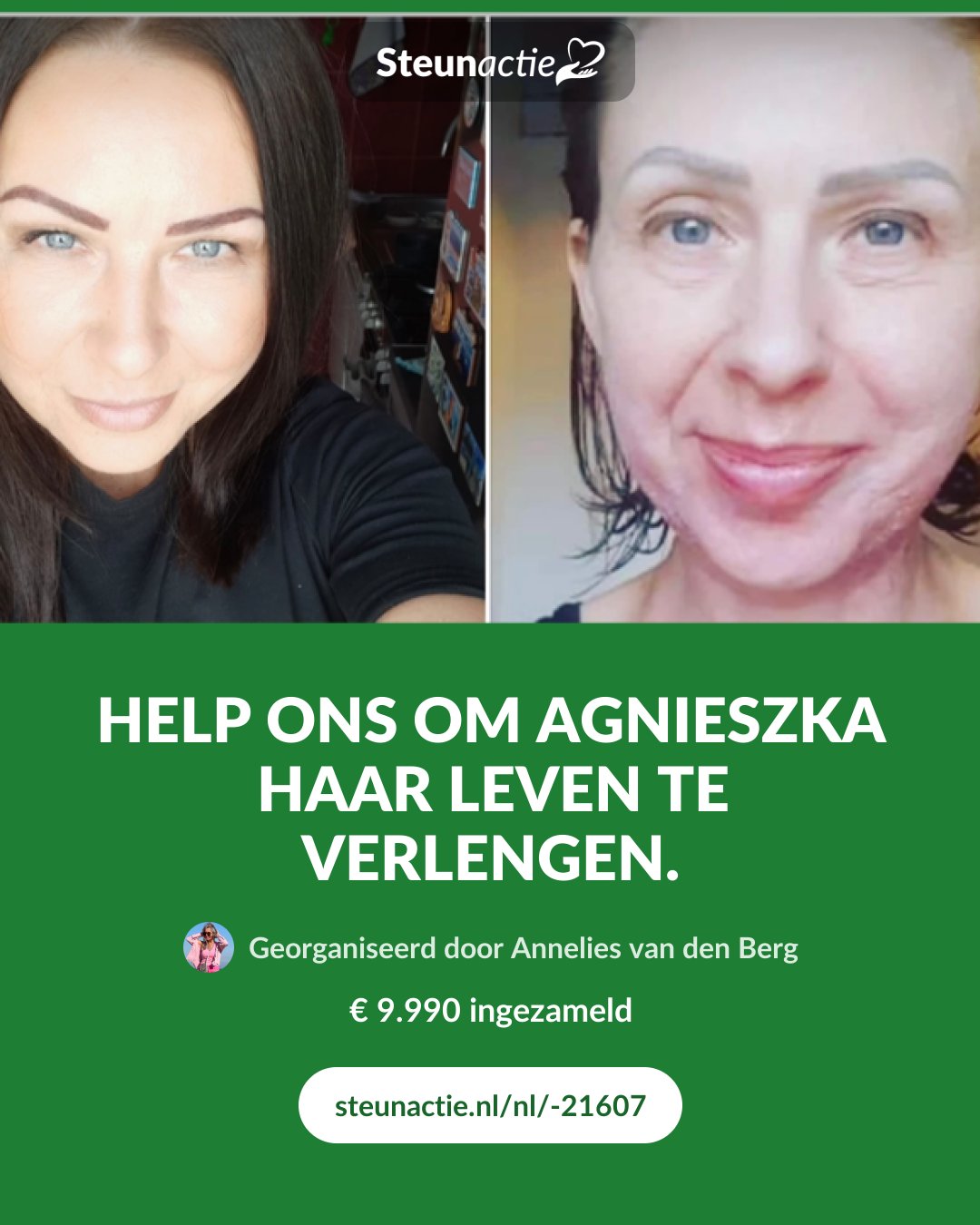 Voorbeeld van de afbeelding