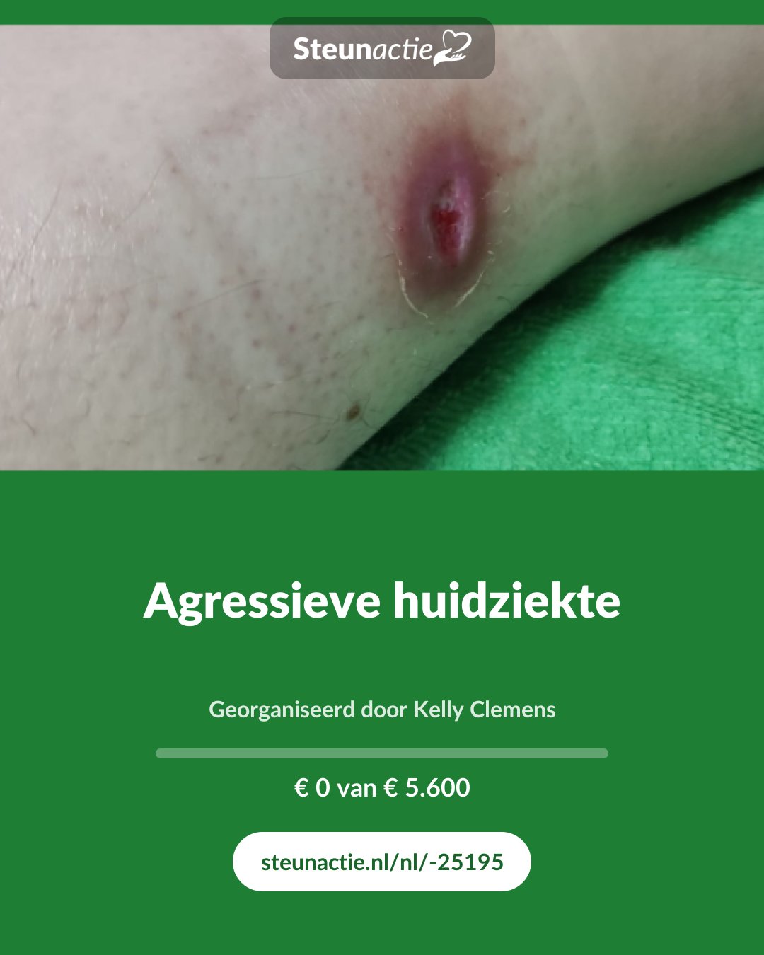 Voorbeeld van de afbeelding