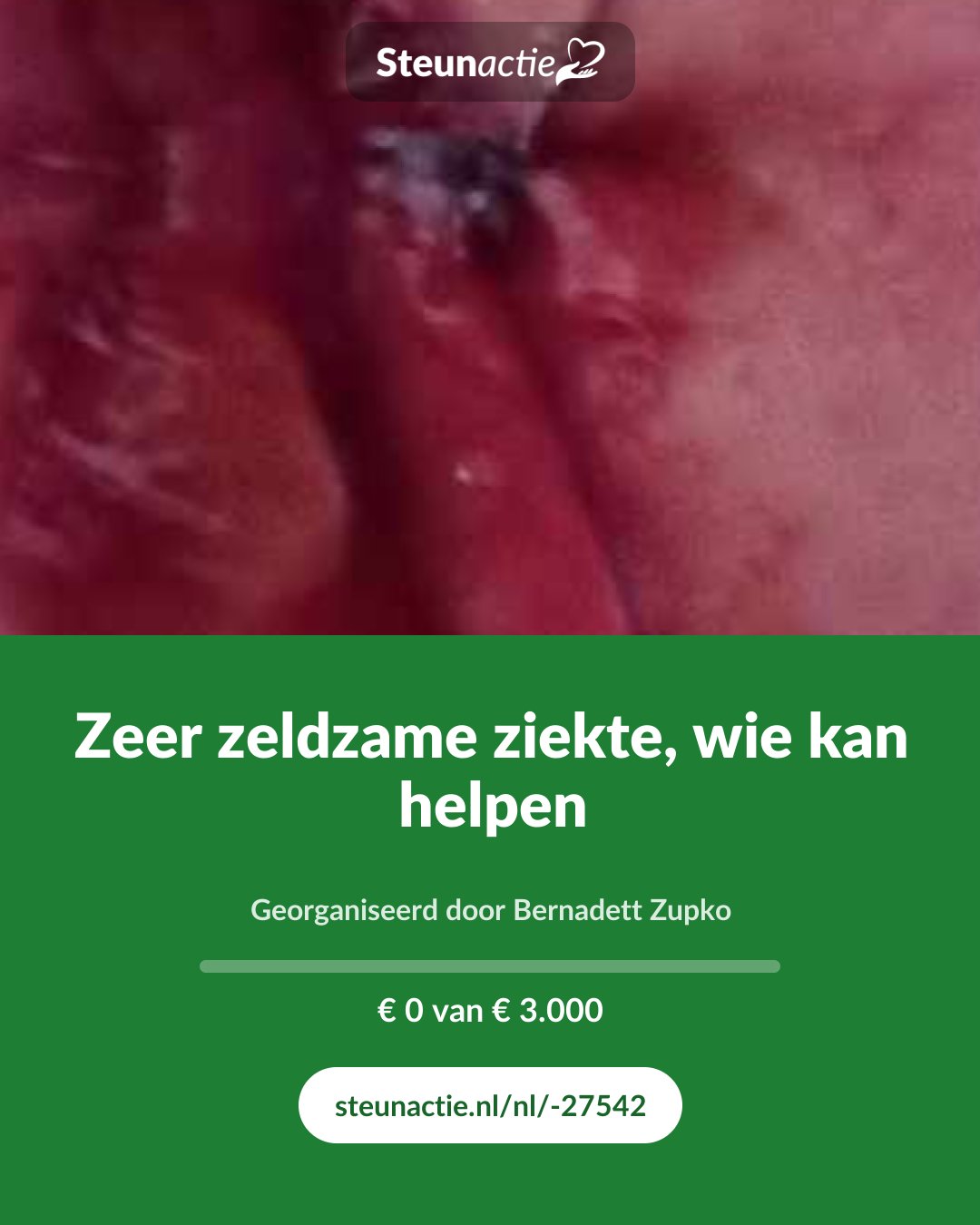 Voorbeeld van de afbeelding