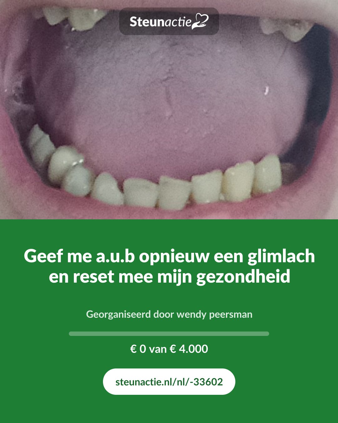 Voorbeeld van de afbeelding