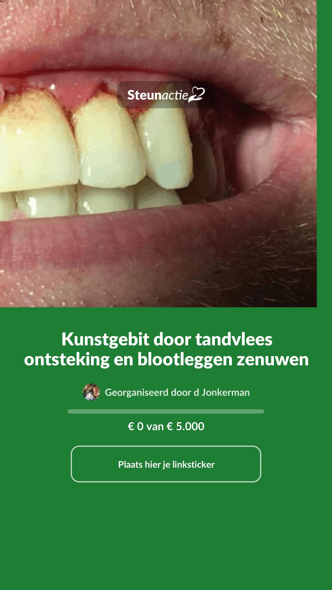 Voorbeeld van de afbeelding