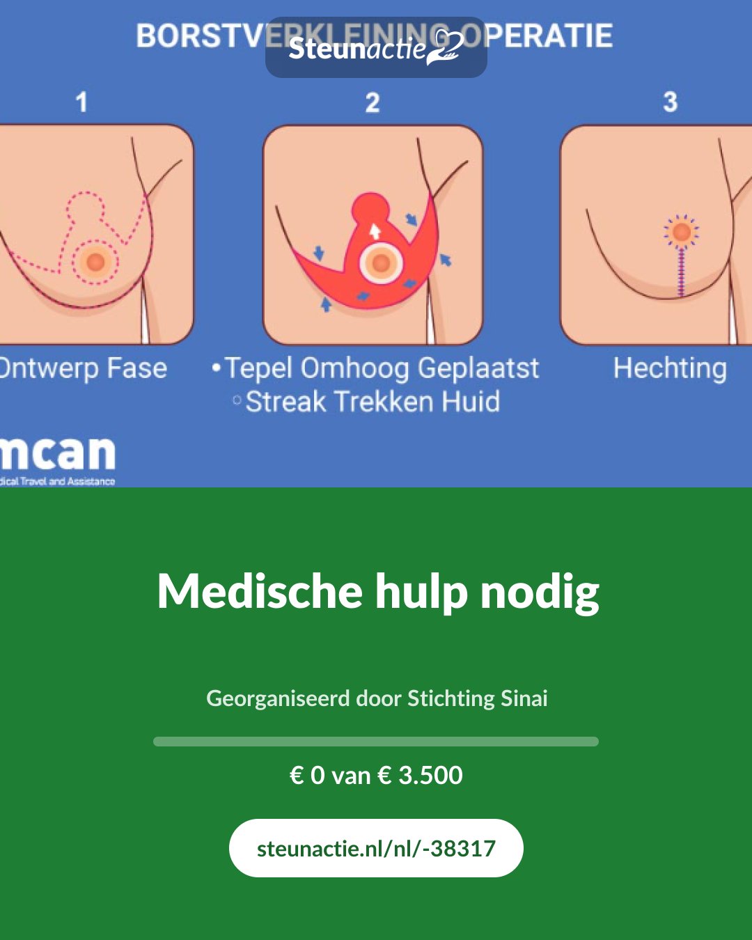 Voorbeeld van de afbeelding