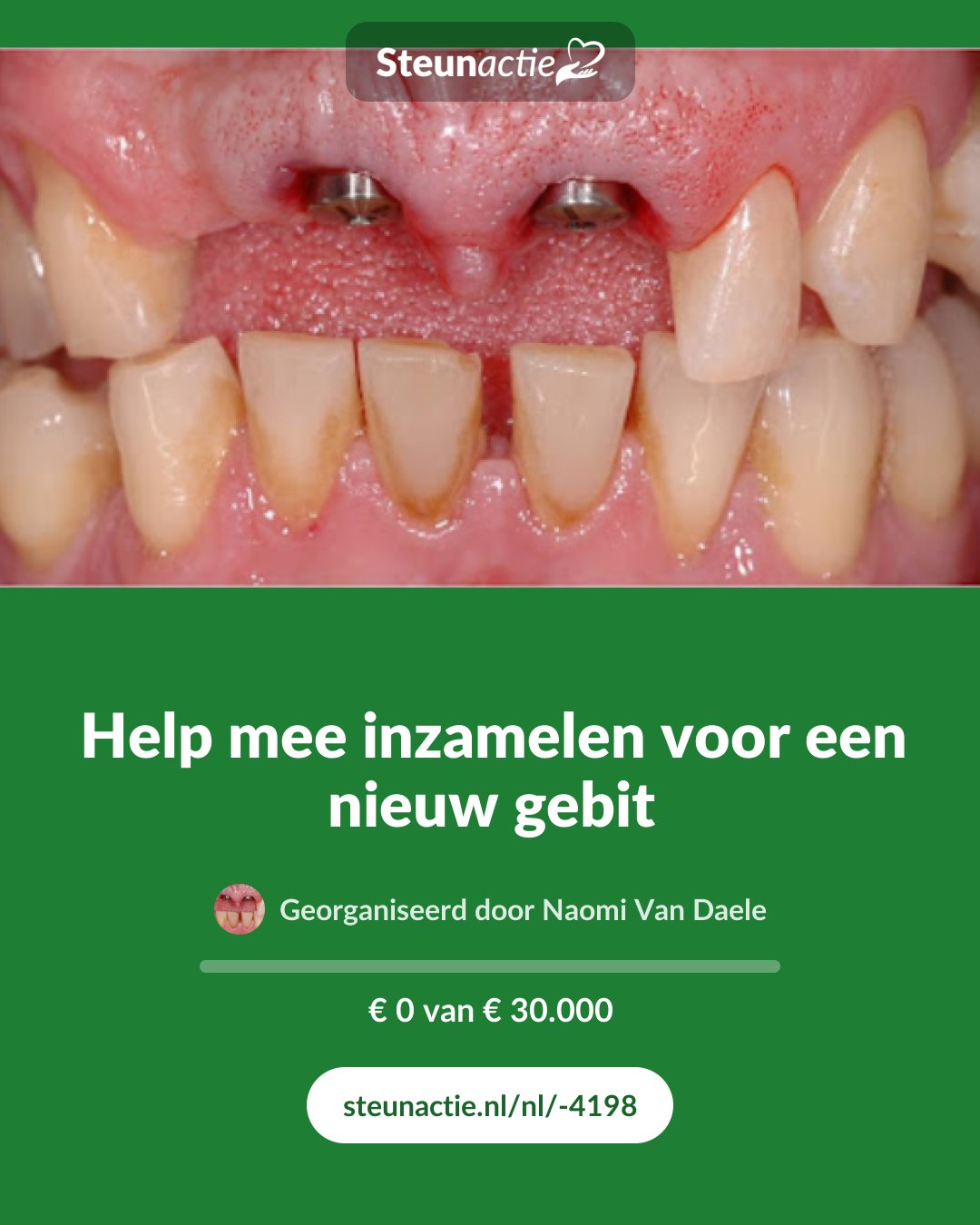 Voorbeeld van de afbeelding