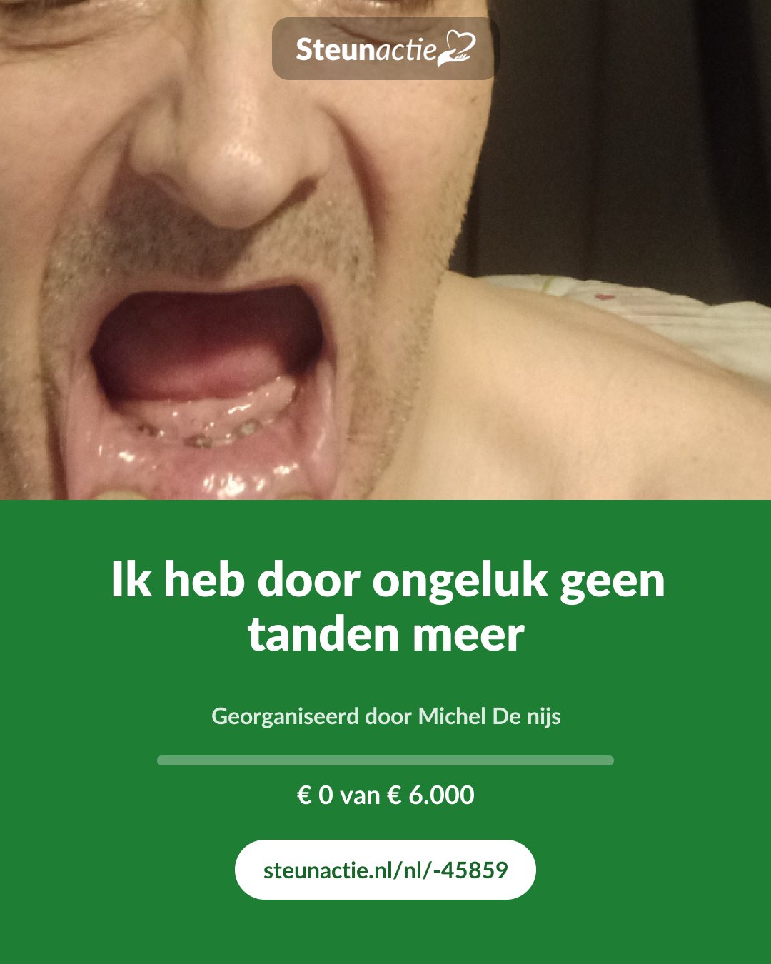 Voorbeeld van de afbeelding