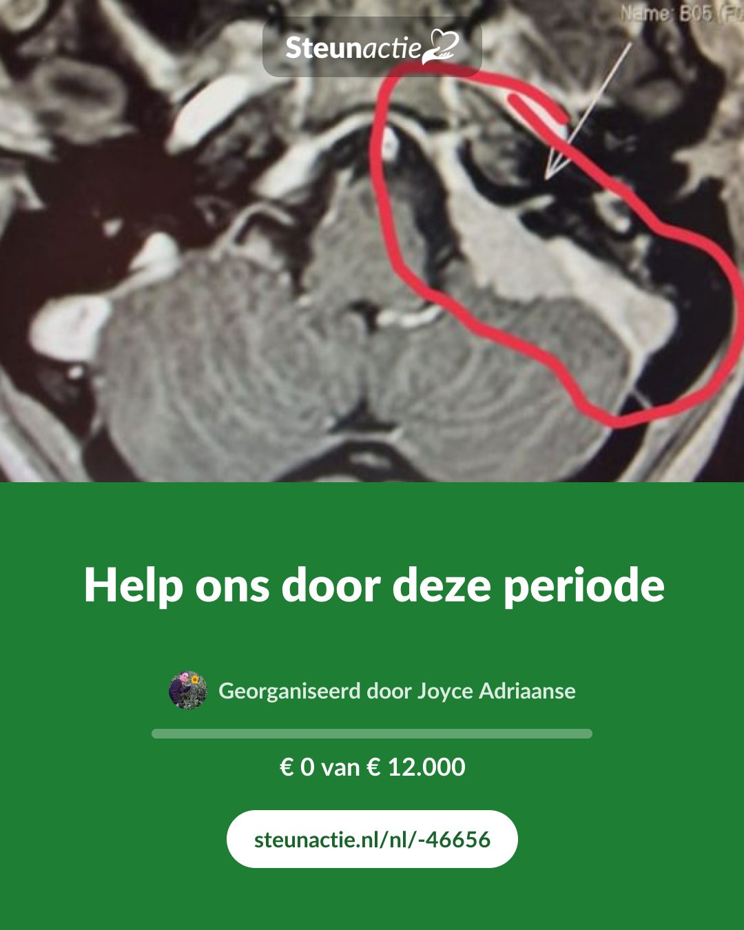 Voorbeeld van de afbeelding