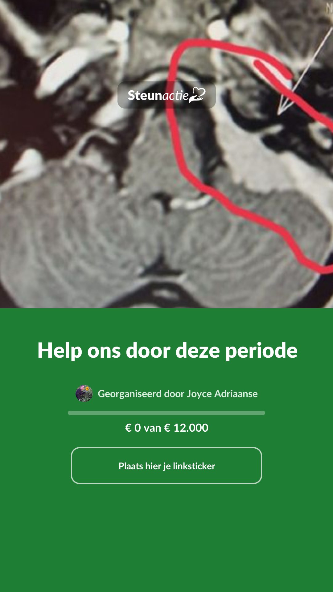 Voorbeeld van de afbeelding