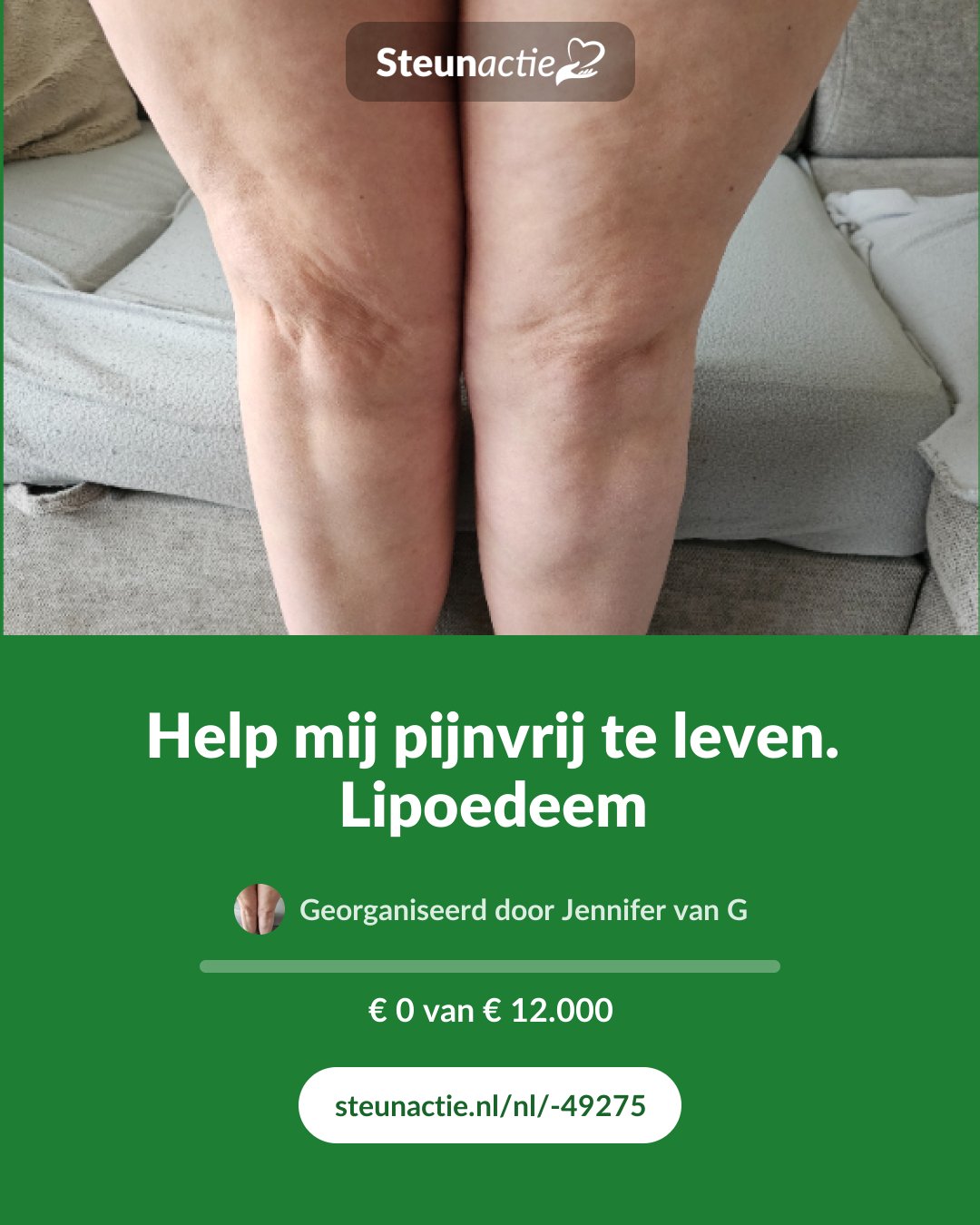Voorbeeld van de afbeelding