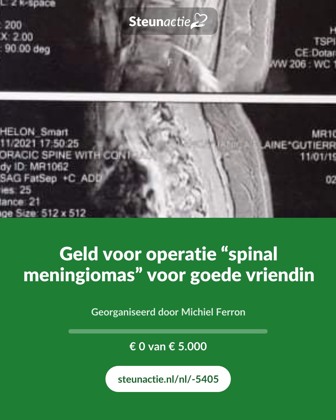 Voorbeeld van de afbeelding