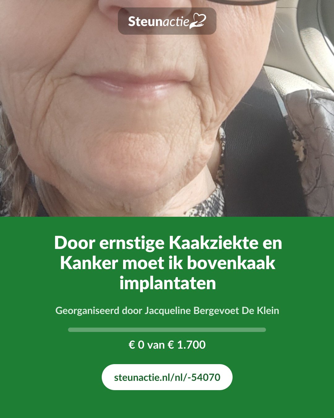 Voorbeeld van de afbeelding