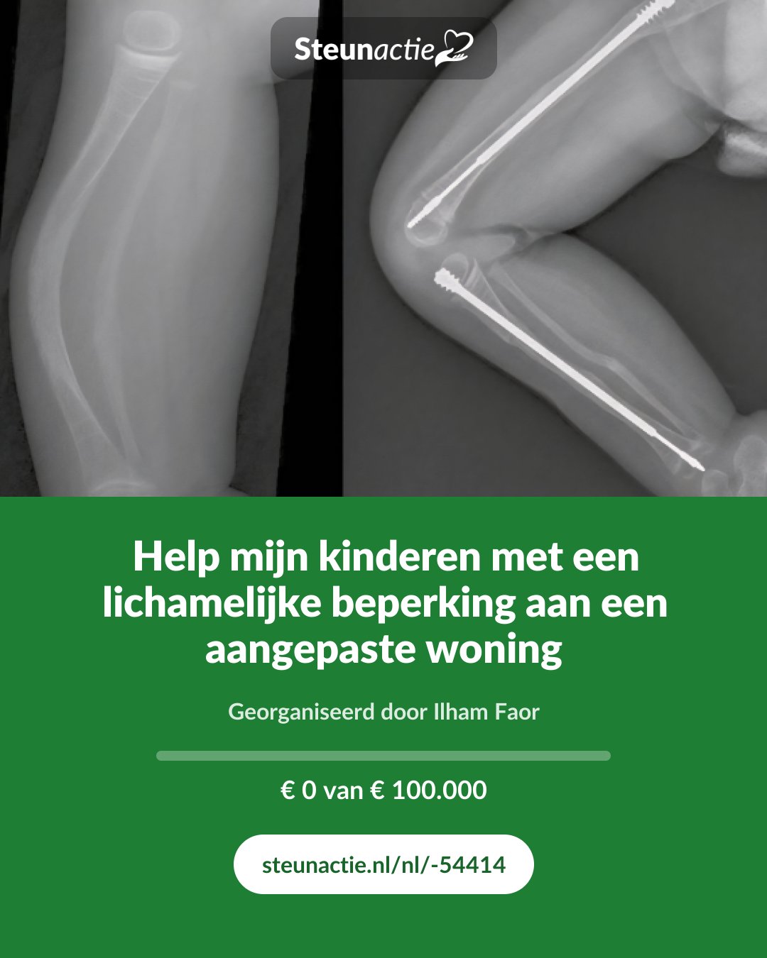 Voorbeeld van de afbeelding