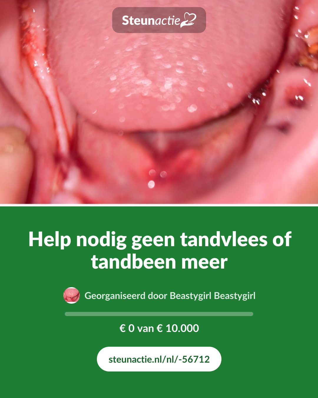 Voorbeeld van de afbeelding