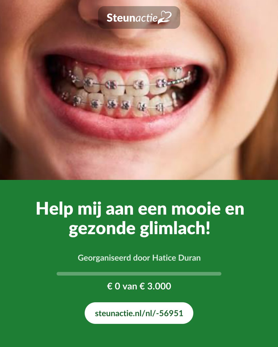 Voorbeeld van de afbeelding