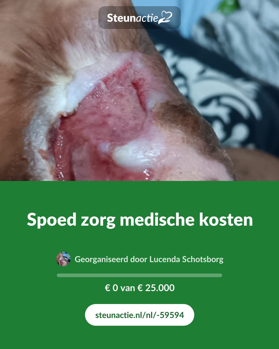 Voorbeeld van de afbeelding