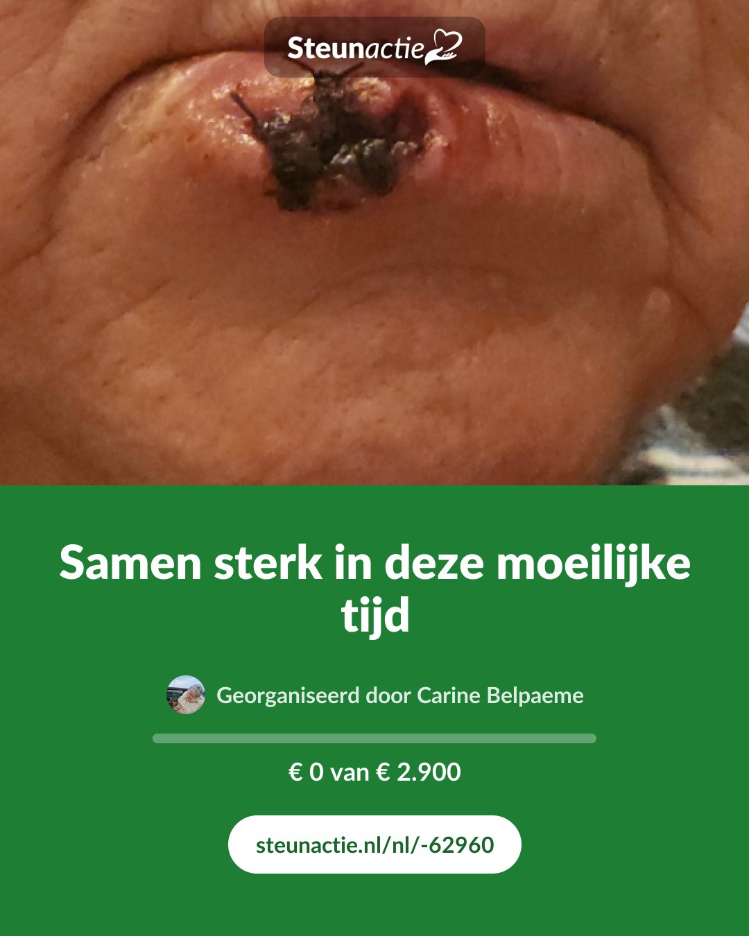 Voorbeeld van de afbeelding