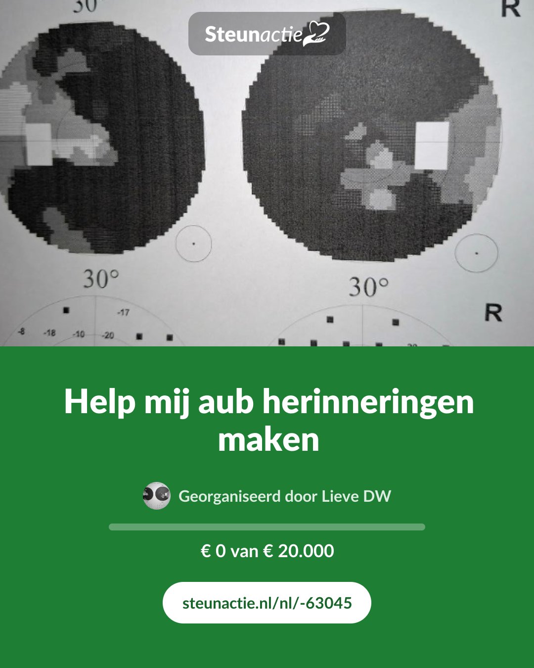 Voorbeeld van de afbeelding