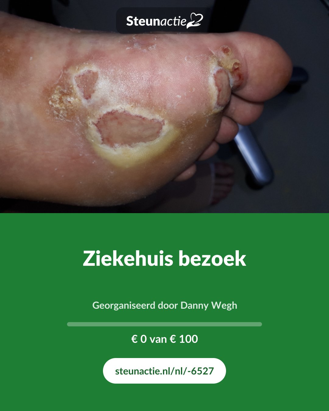 Voorbeeld van de afbeelding