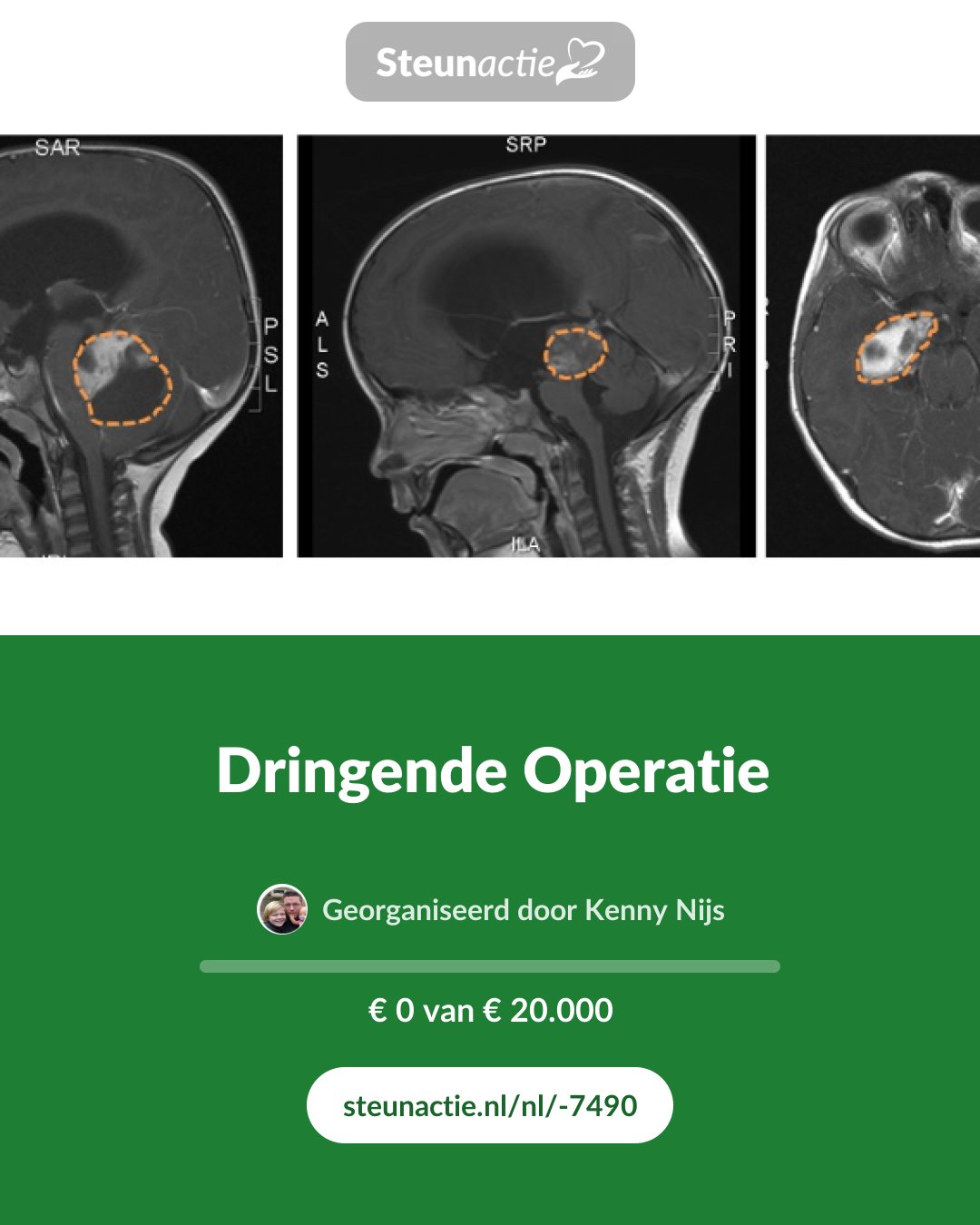 Voorbeeld van de afbeelding