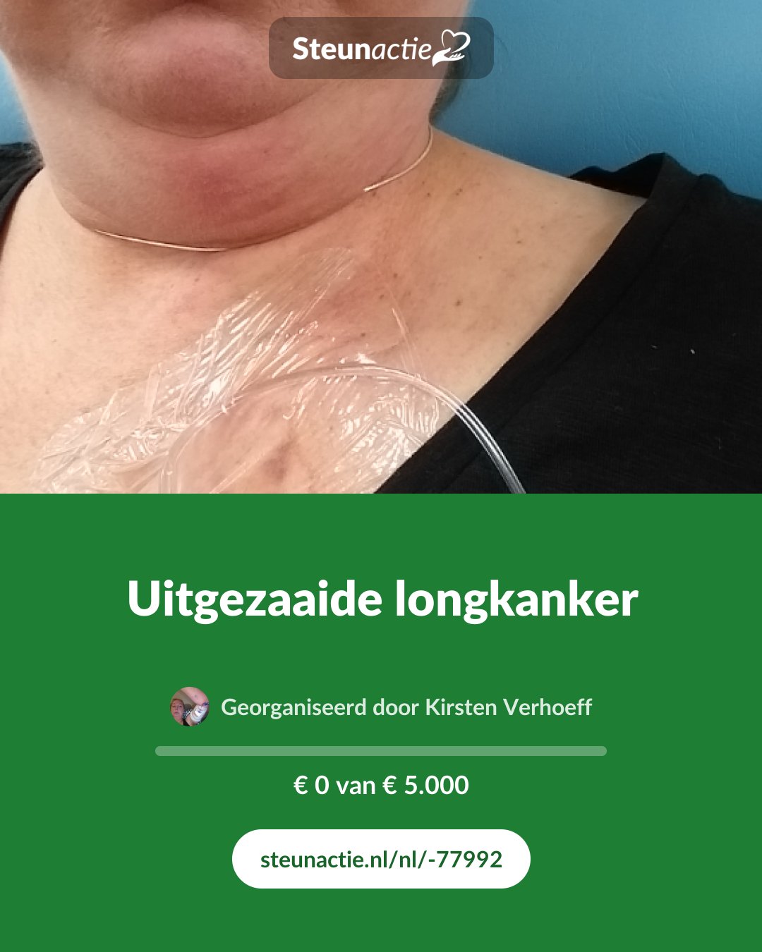 Voorbeeld van de afbeelding