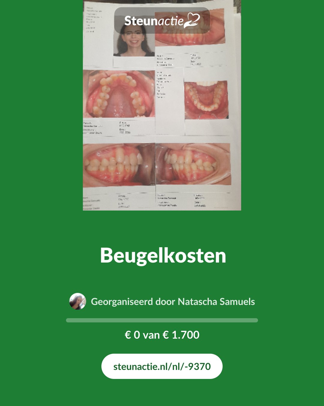 Voorbeeld van de afbeelding
