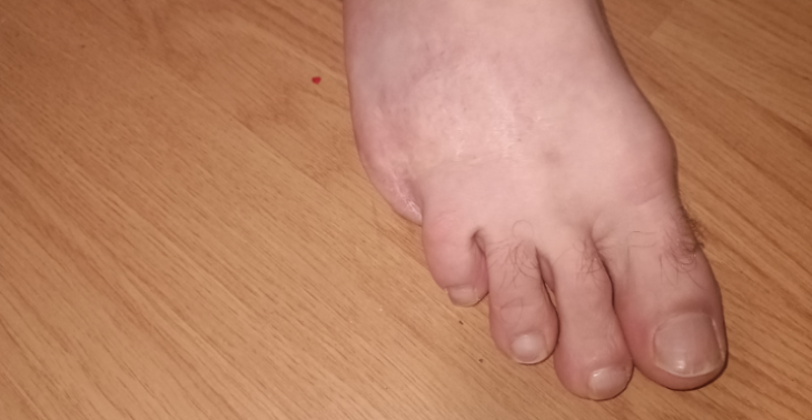 Help mee om een kleine stap groot te maken!