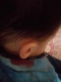 inured head no 2